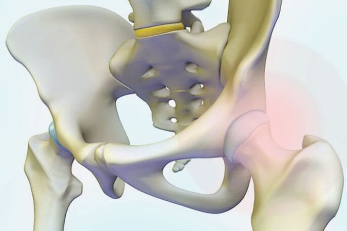 pain in the hip joint