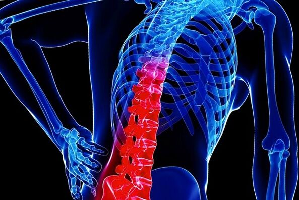 Reasons for the development of chest osteoarthritis