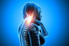 Linkrosis in the cervical spine
