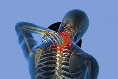 Pain in the neck with osteoarthritis