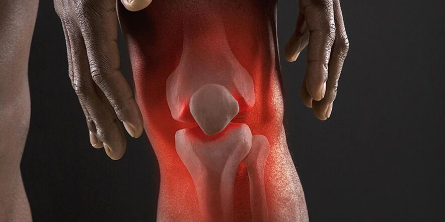 A burning sensation in the knee area is a symptom of gonorrhea